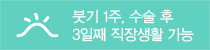 붓기 1주, 수술 후 3일째 직장생활 가능