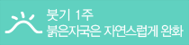 붓기 1주, 붉은 자국은 자연스럽게 완화
