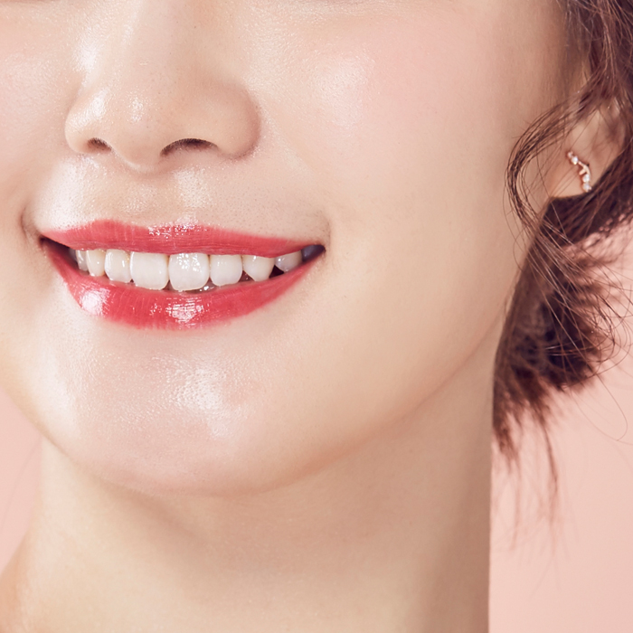 입꼬리성형  썸네일 이미지