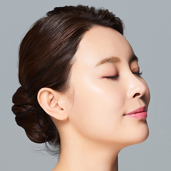 코 필러 시술 후 제거도 간편하게 가능할까?  썸네일 이미지