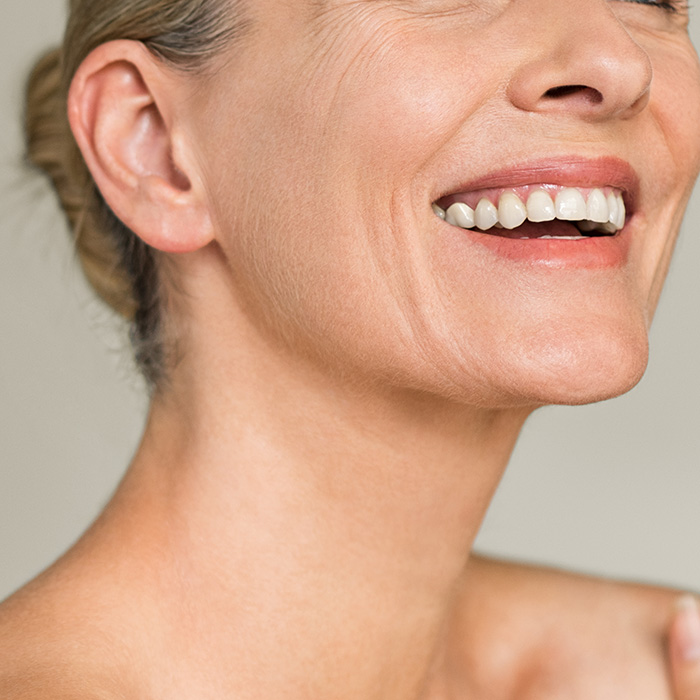 Midface Lift: Solution for Under-Eye Sa... Thumbnail