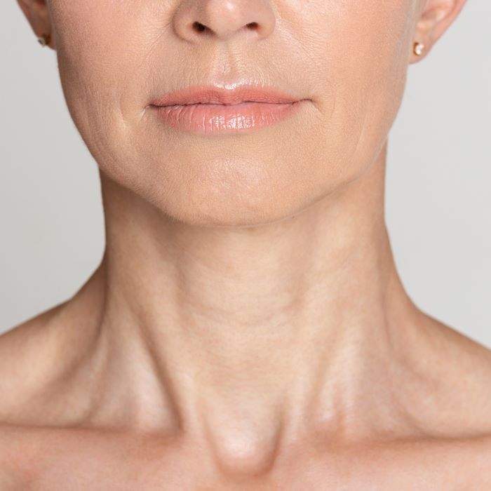 Можно ли уменьшить морщины на шее с помощью продцедур? Thumbnail