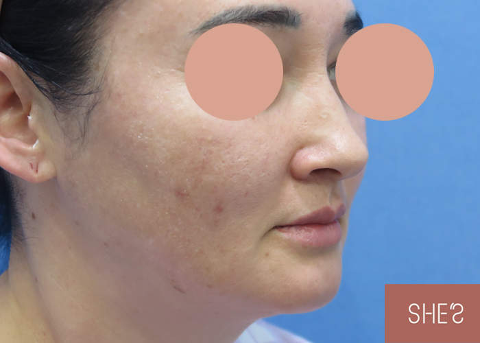 Фото до и после | Новости | She's Plastic Surgery