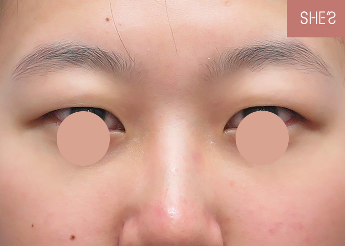 ビフォーアフター ストーリー She S整形外科