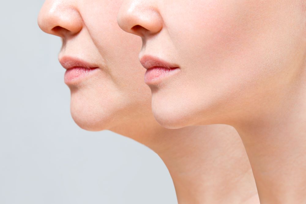 쉬즈성형외과, 부산성형외과, 부산, 남포동성형외과