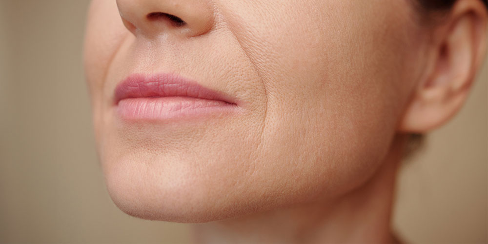 深層拉提手術，喚回年輕線條!